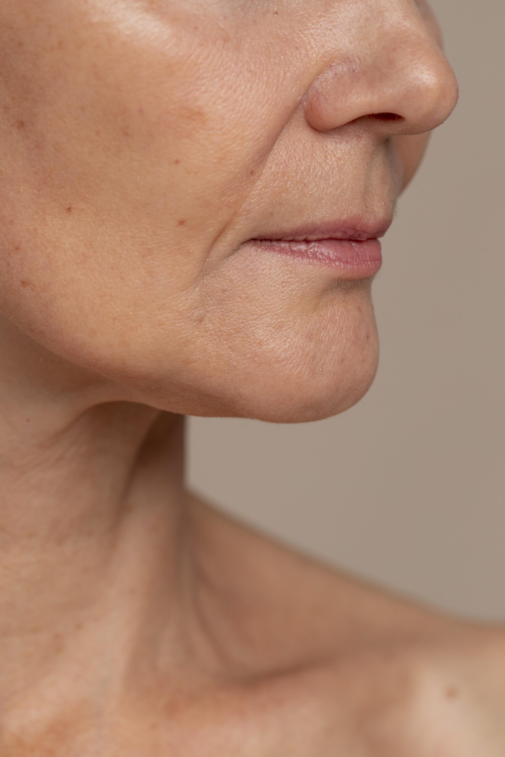 Blog Lifting facial vs hilos tensores