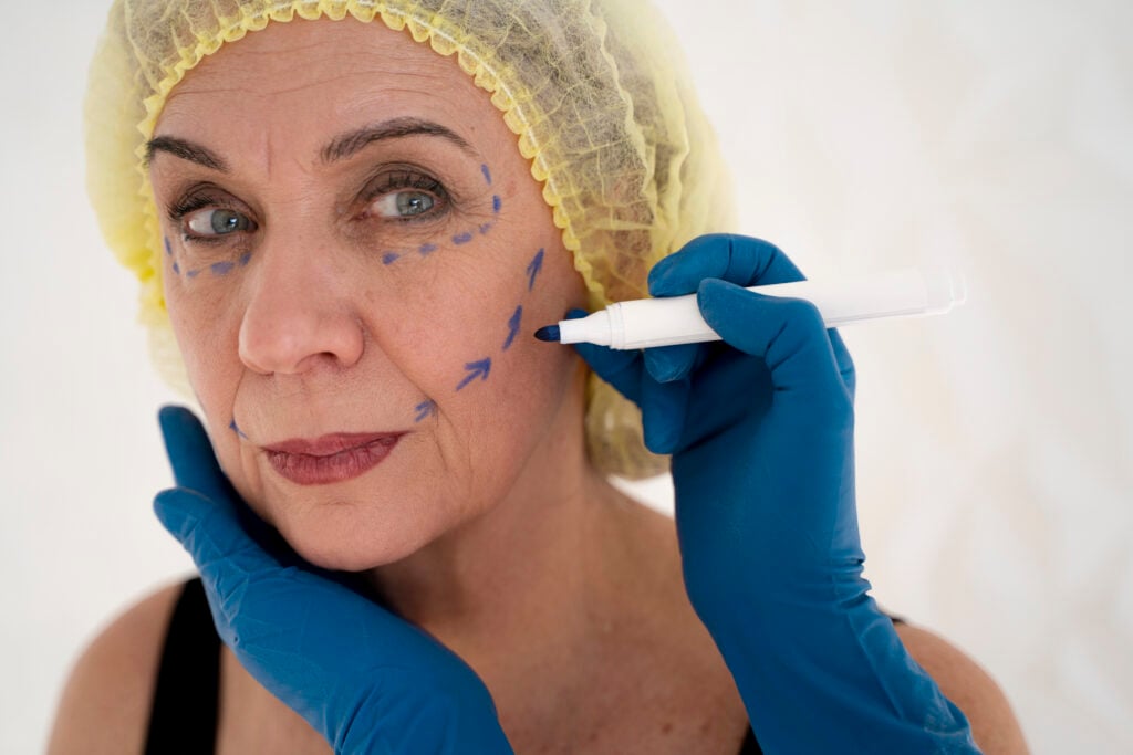 diferencia entre Endolifting y Lifting Facial